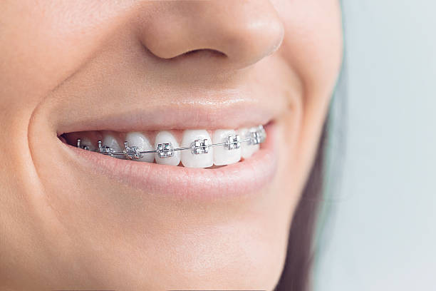 Best Traditional Braces  in Scotchtown, NY